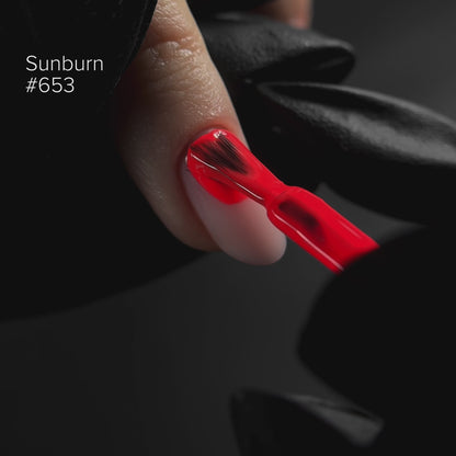 #653 SUNBURN